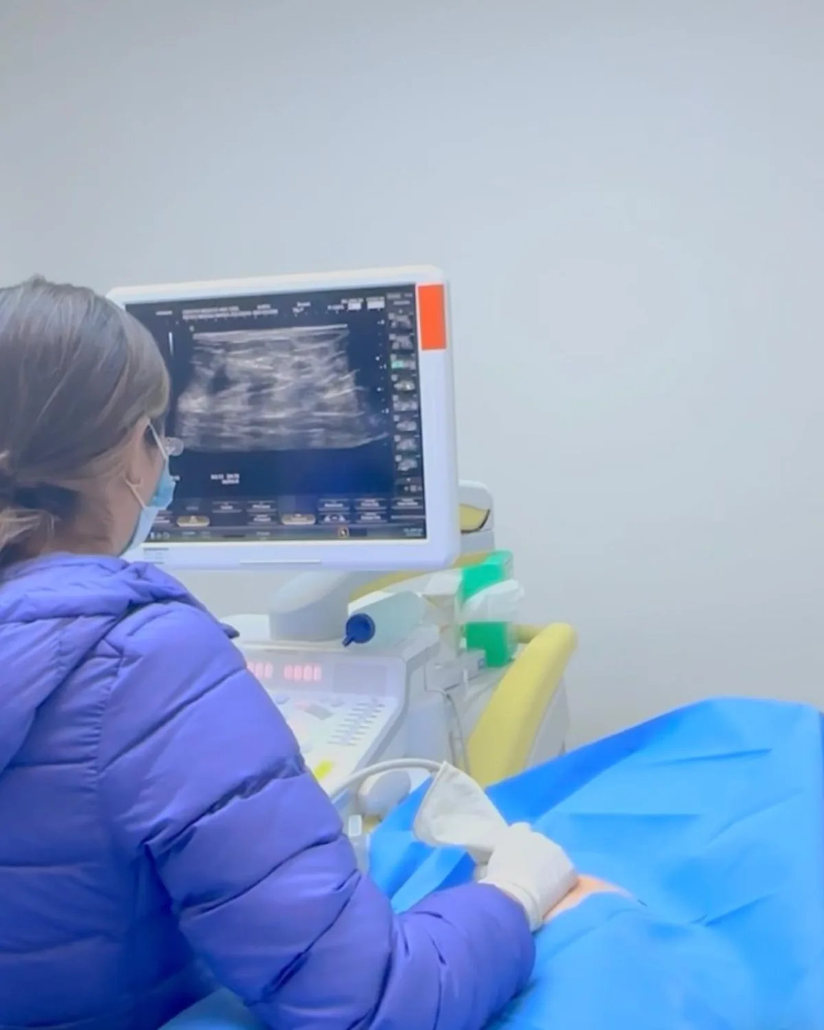 Ultrasonido mamario en curso durante una biopsia guiada por imagen